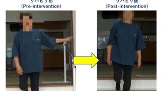 Why Does "Unsteadiness" Occur After a Stroke? 3 Key Elements of Balance to Prioritize in Rehabilitation